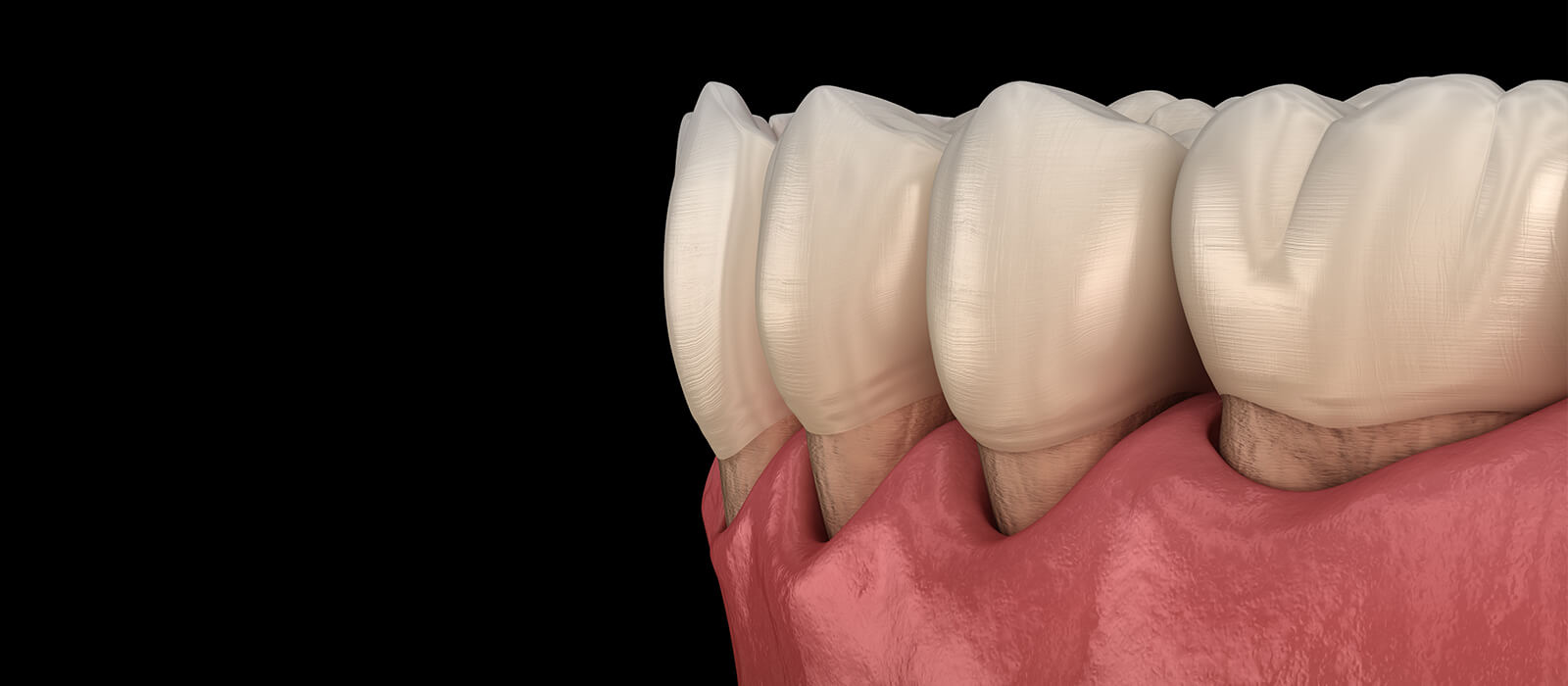 当院の歯周病治療の特徴、診療方針