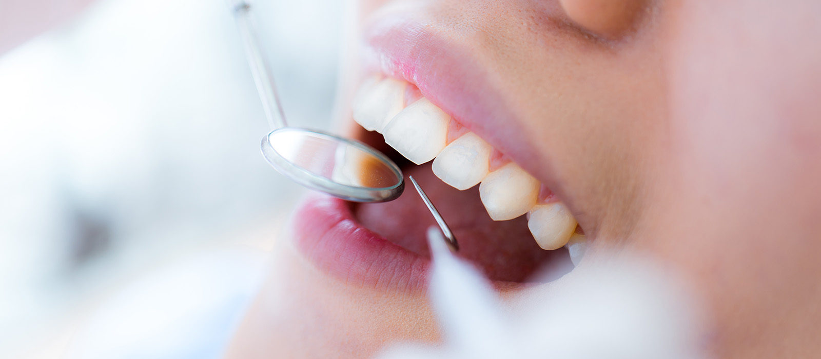 訪問歯科で行う歯科治療